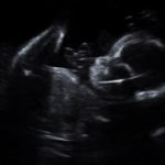 узи киев голосеевский район